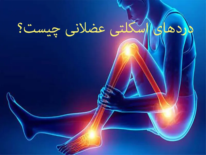 دردهای اسکلتی عضلانی یا فیبرومیالژیا چیست؟